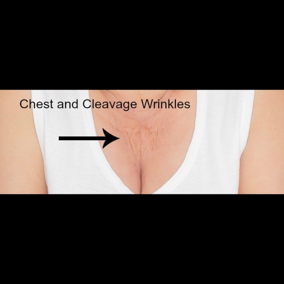 Chest wrinkle ease - Picture 2 of 6